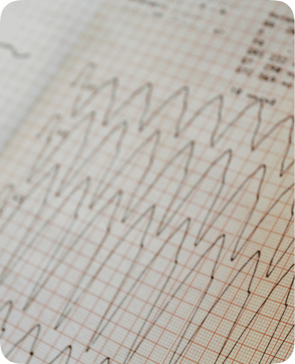 ECG