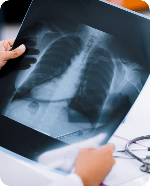 X-Ray